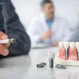 Can Smokers Get Implants? Risks and Next Steps