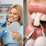 Smile Design vs Veneers: Which Is Right?
